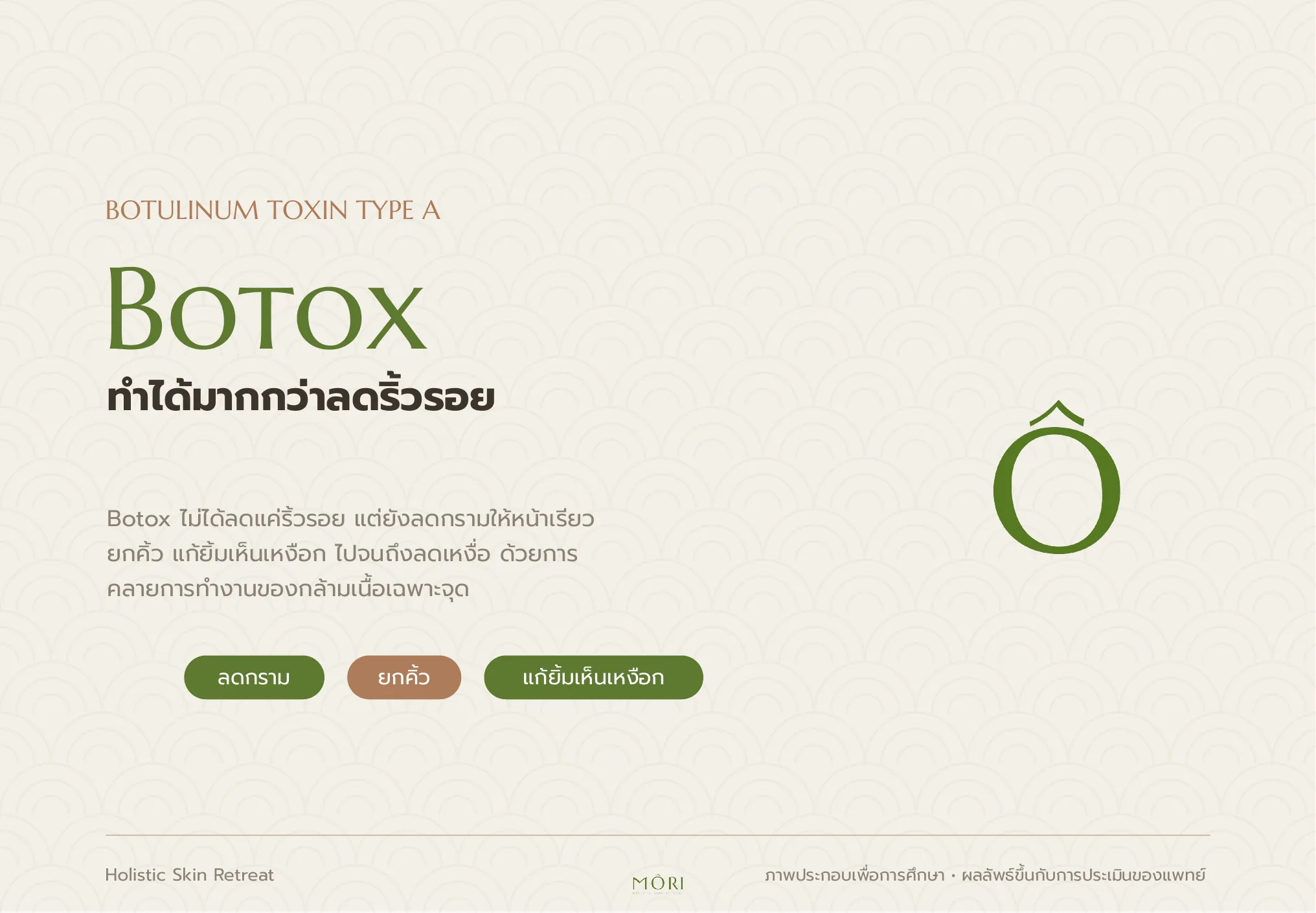 Botox