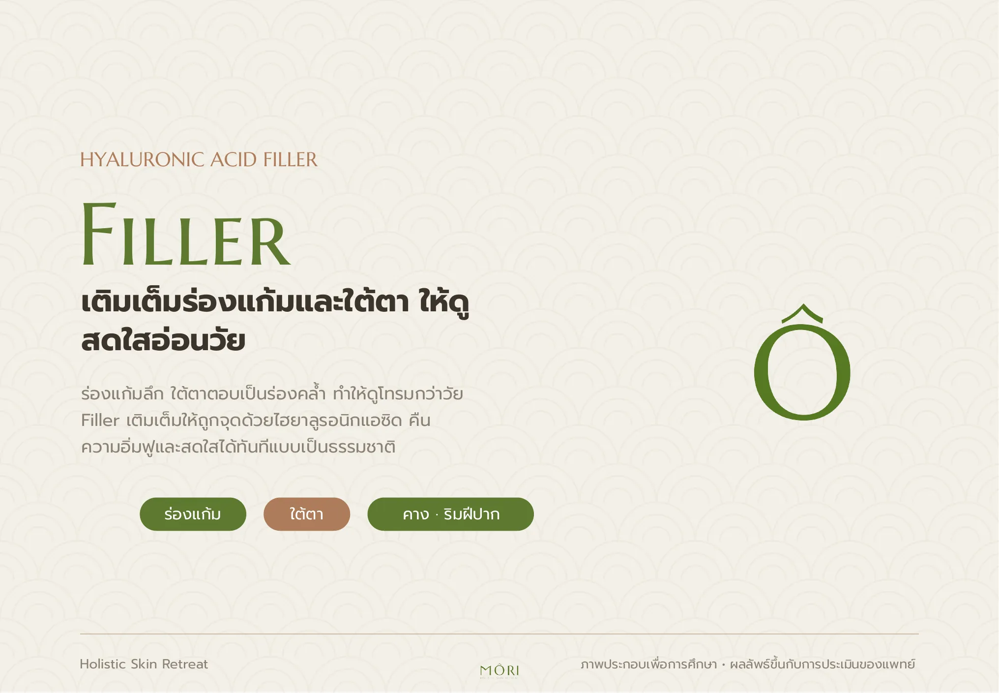 Filler
