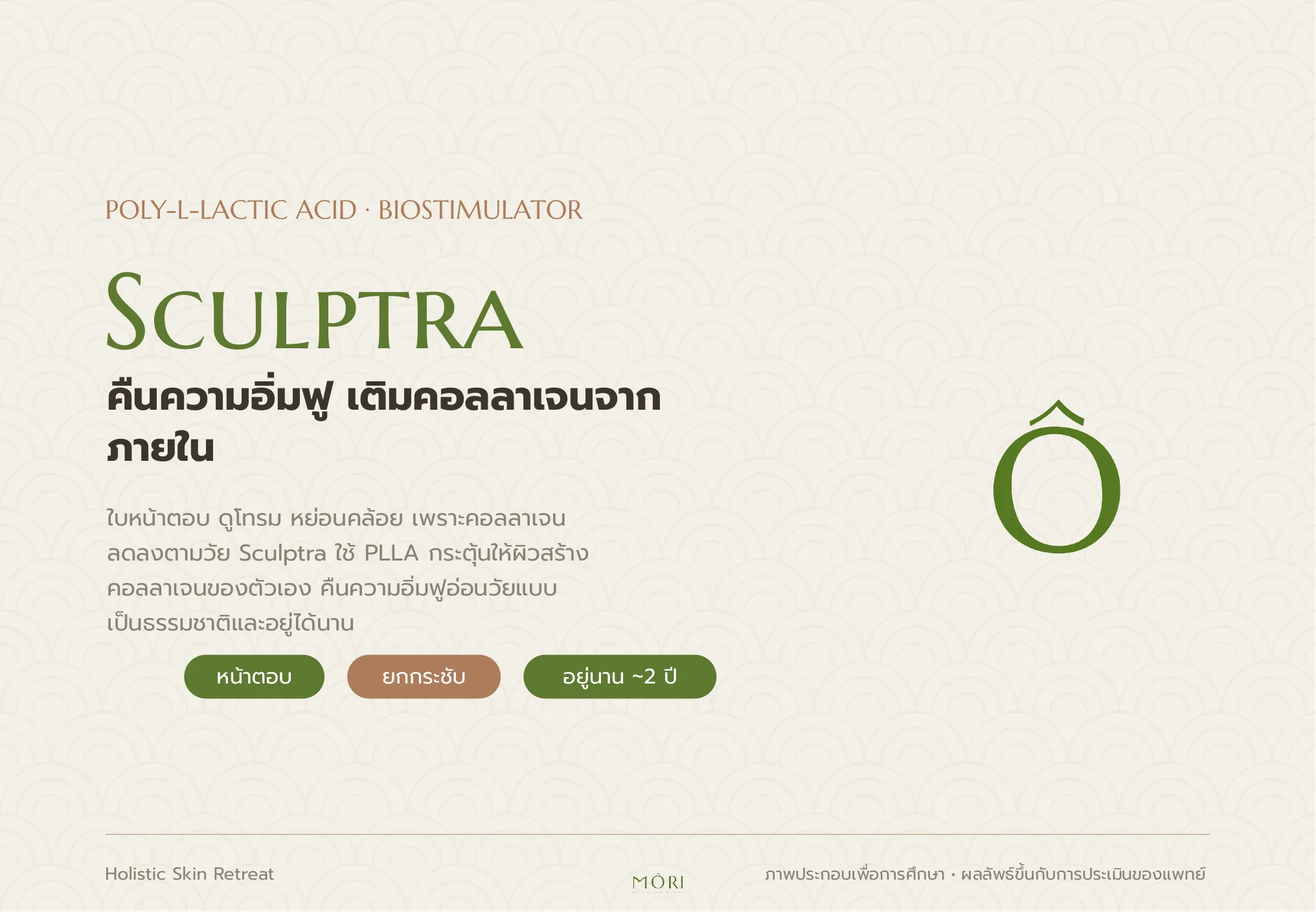Sculptra
