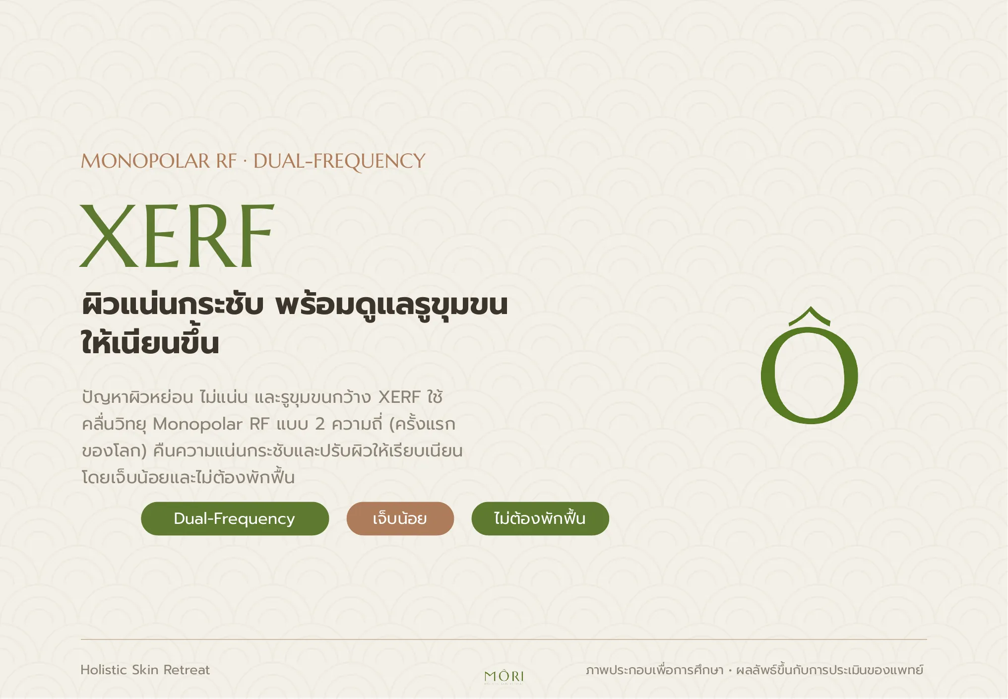 XERF