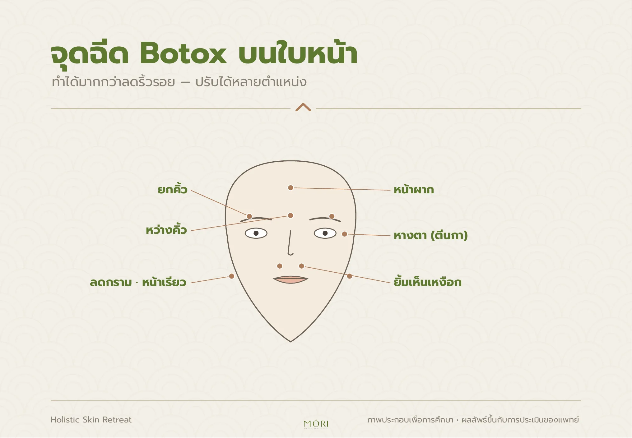Botox
