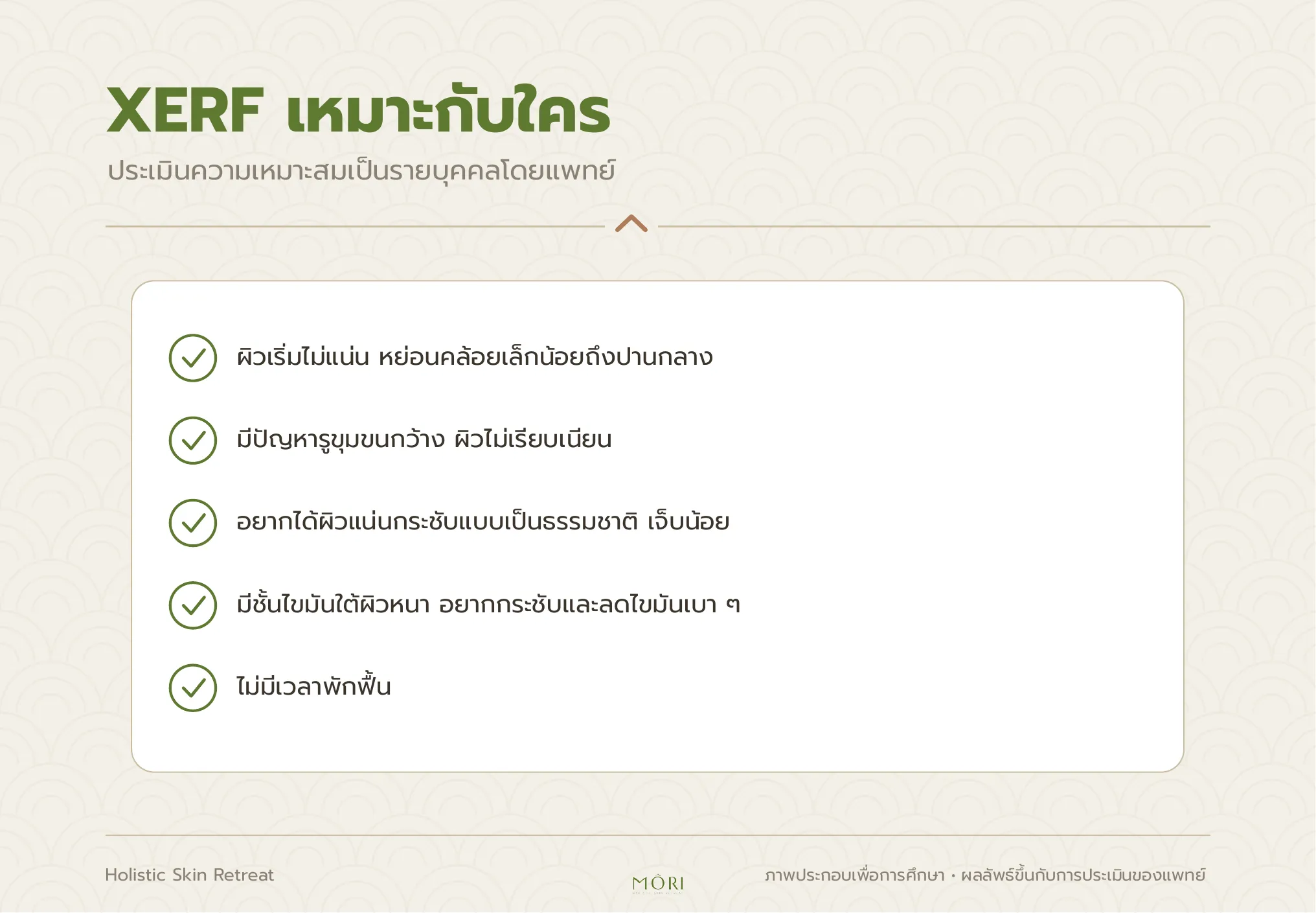 XERF
