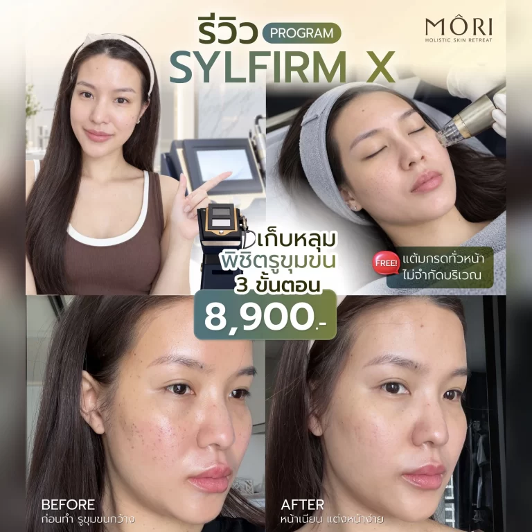 โปรโมชัน รีวิว Sylfirm X Mori Clinic